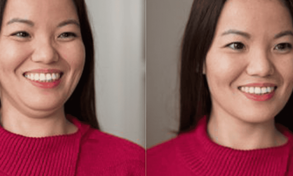 Chin Up: Tricks for a Double Chin-Free Photo